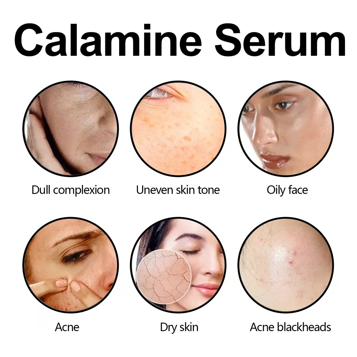 Calamine Serum, Improve Skin Dry Dull Acne Muscle Acne Hydrating Plump - V.I.P Digital Presence