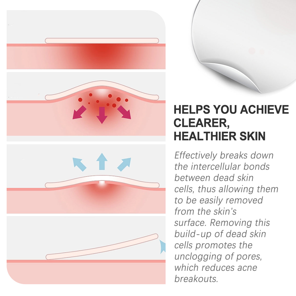 Acne Patch, Repair Acne Pimples Acne Invisible Concealer Breathable Acne Patch - V.I.P Digital Presence