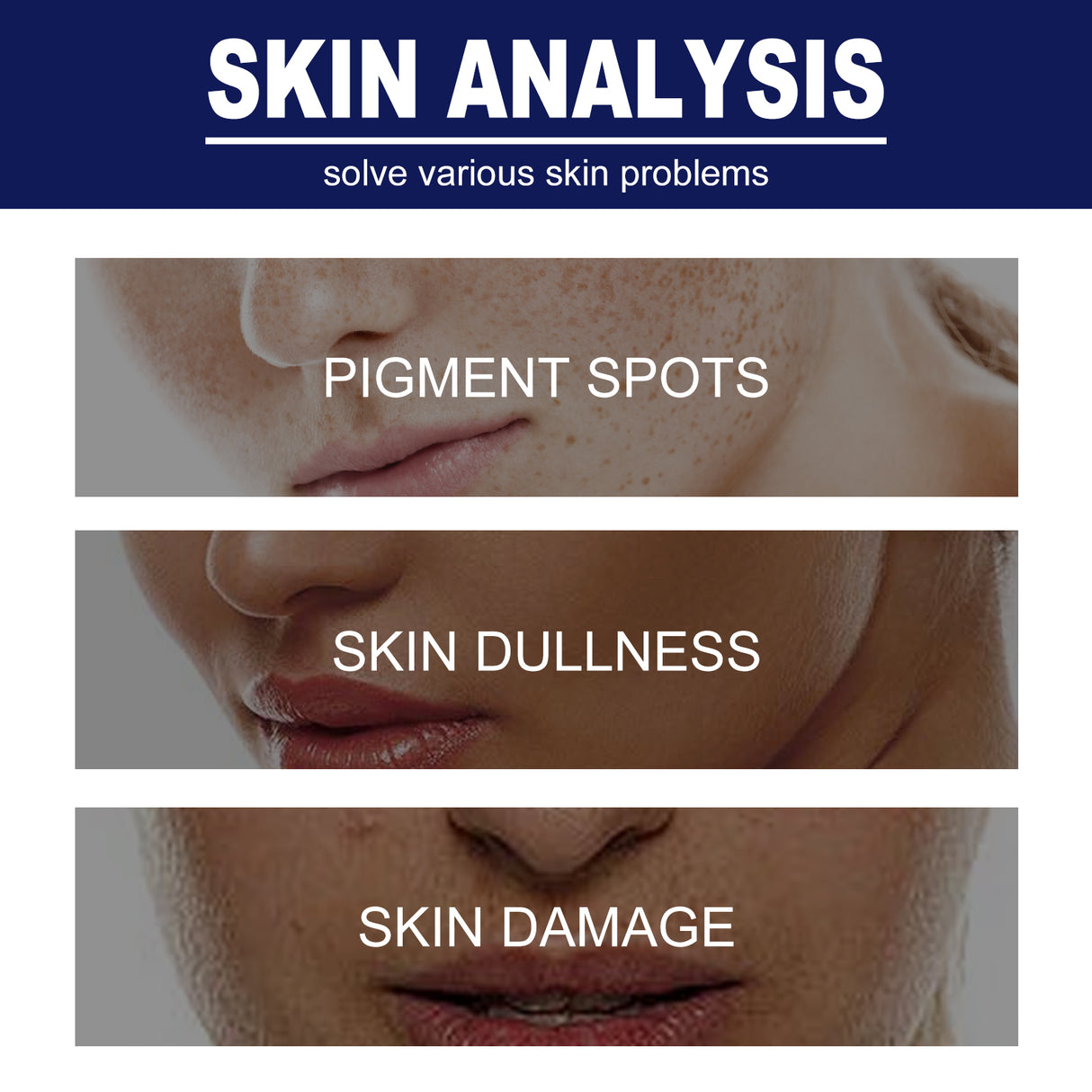 Skin Genesis Spot Whitening Cream, Filling Water To Moisten Soft Delicate Chun White Brighten The Melanin Of Skin Cream - V.I.P Digital Presence