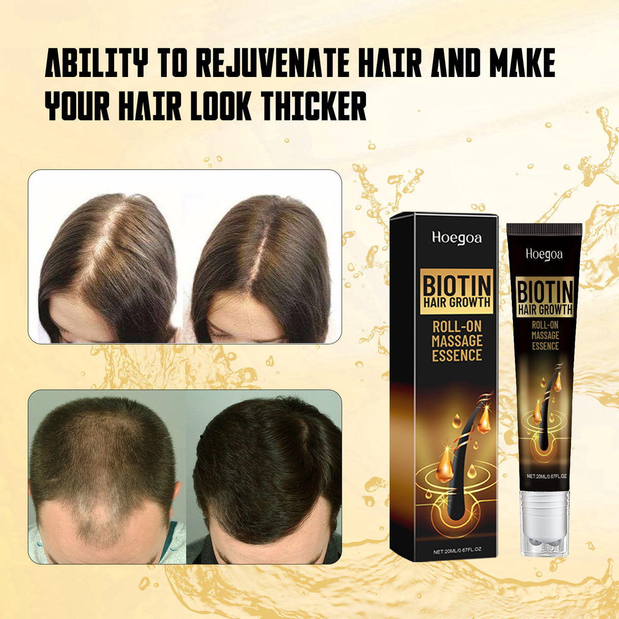 Biotin Hair Growth Roll On Massage Essence, Strong Hair Nourishing Hair Root Repair Dry Hair Essence - V.I.P Digital Presence