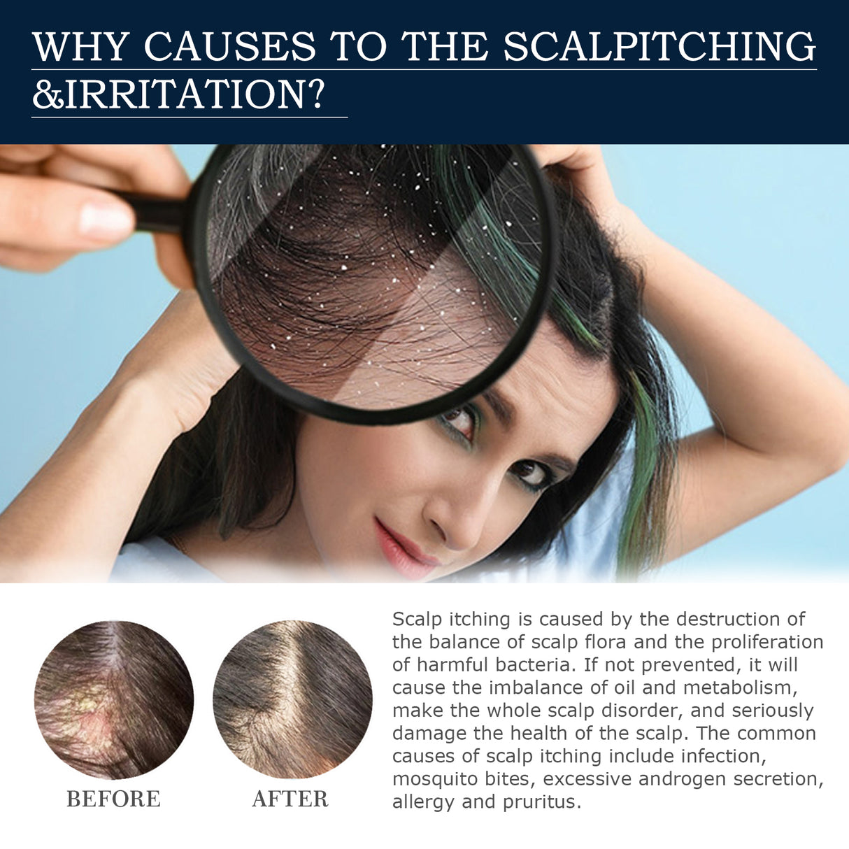 Scalp Treatment Essence Spray, Hair Care And Repair Damaged Hair Follicle Hair Root Treatment Spray - V.I.P Digital Presence