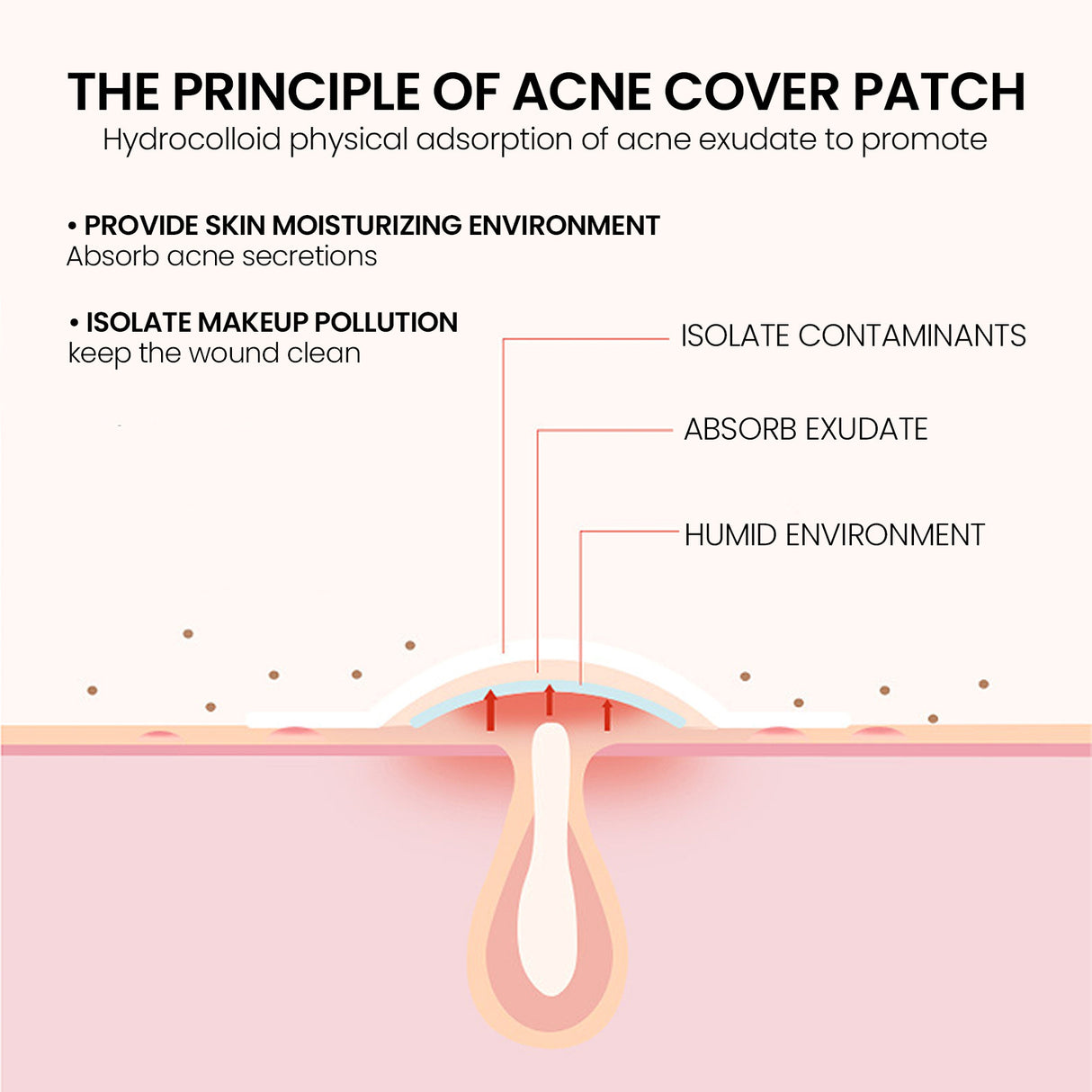 Pimples Patch, Mild Non-Irritant Lightening Pimples Spot Pimples Mark Covering Acne Pimples Patch
