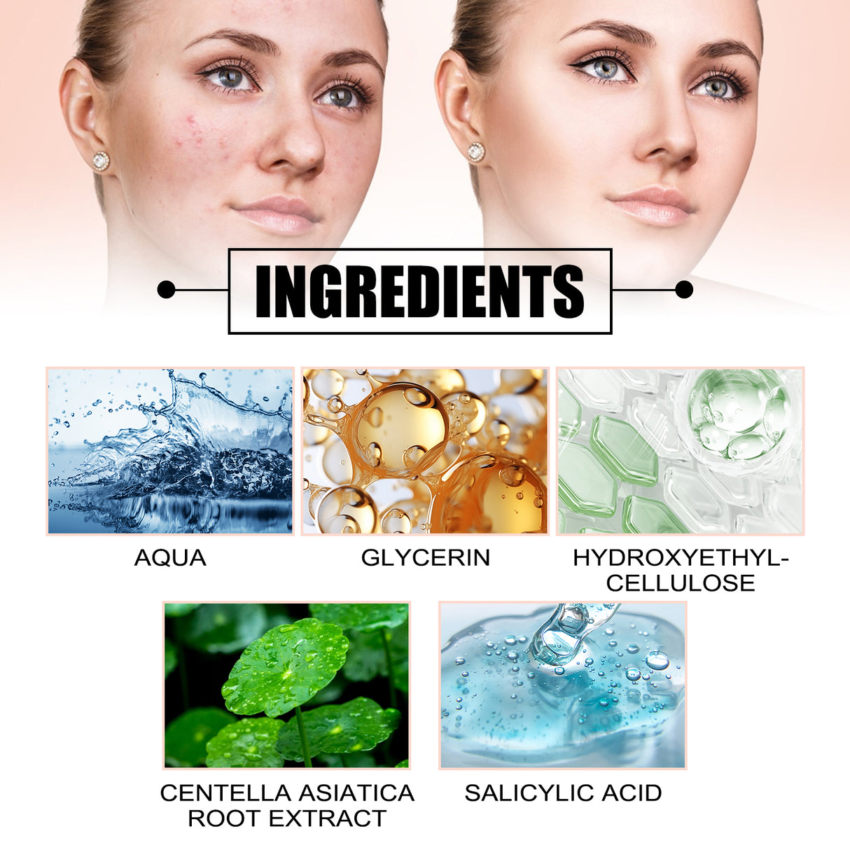 Acne Removal Protection Defense Patch, Color Profile-shaped Portable Invisible Cover Acne Patch - V.I.P Digital Presence