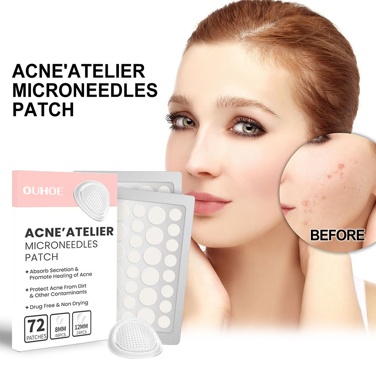 Acne Patch, Repair Acne Pimple Facial Redness Clean Pores Moisturize Skin Patch - V.I.P Digital Presence