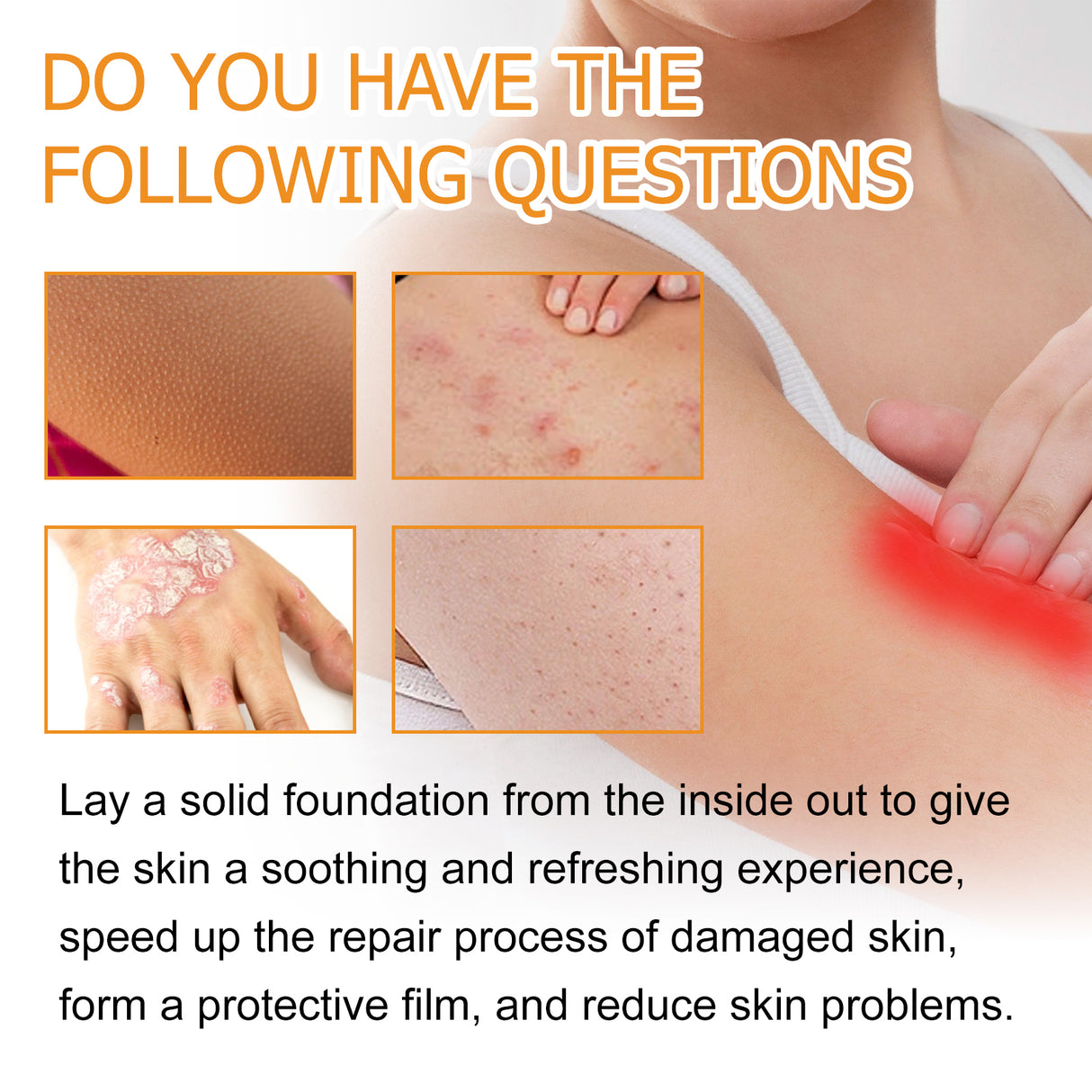 Bee Venom Psoriasis Care Spray, Soothing Skin Irritation Repair Moisturizing And Tender Skin Care Spray - V.I.P Digital Presence