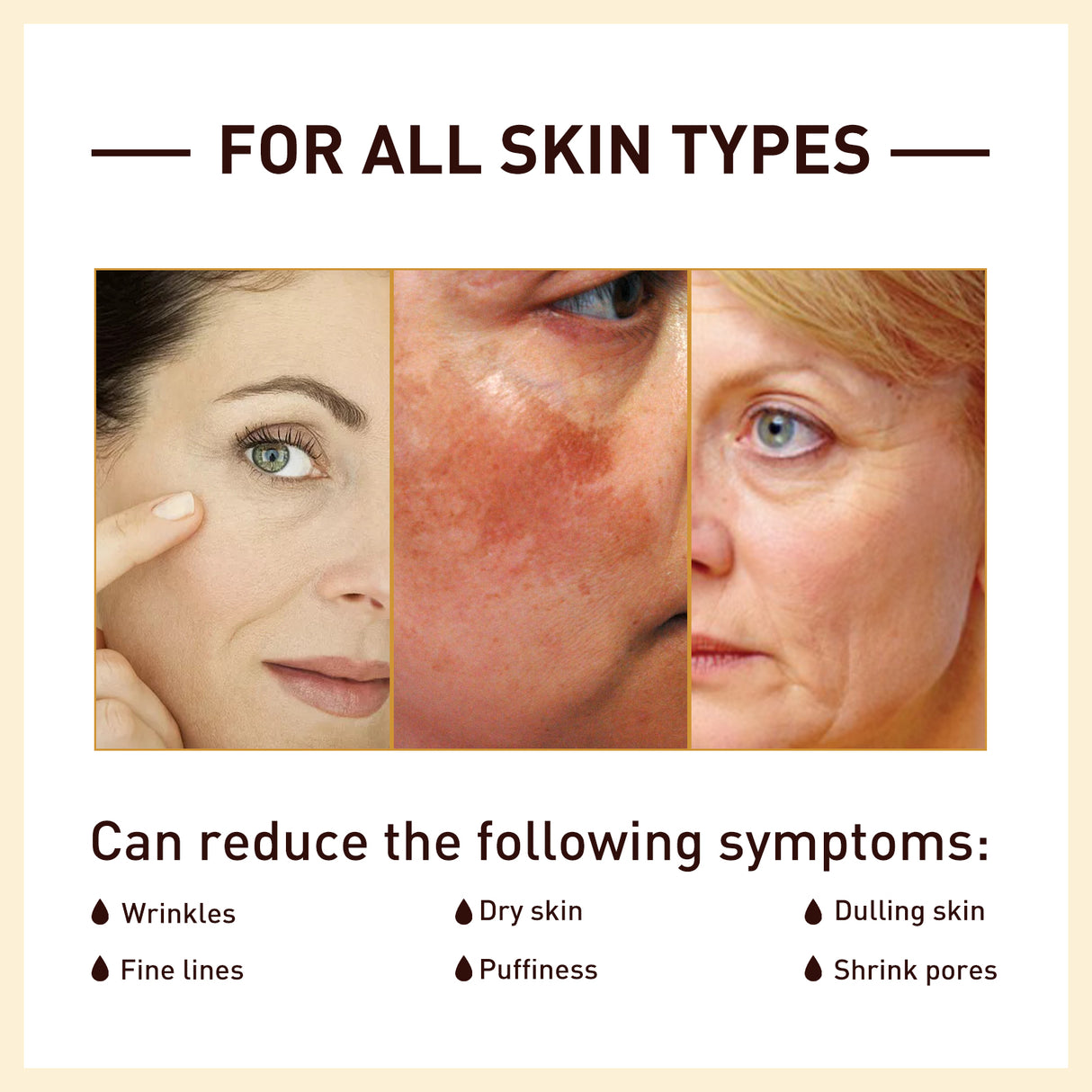 Rice Anti Wrinkle Essence, Repairs Skin Moisturizes Firms Whitens Essence - V.I.P Digital Presence