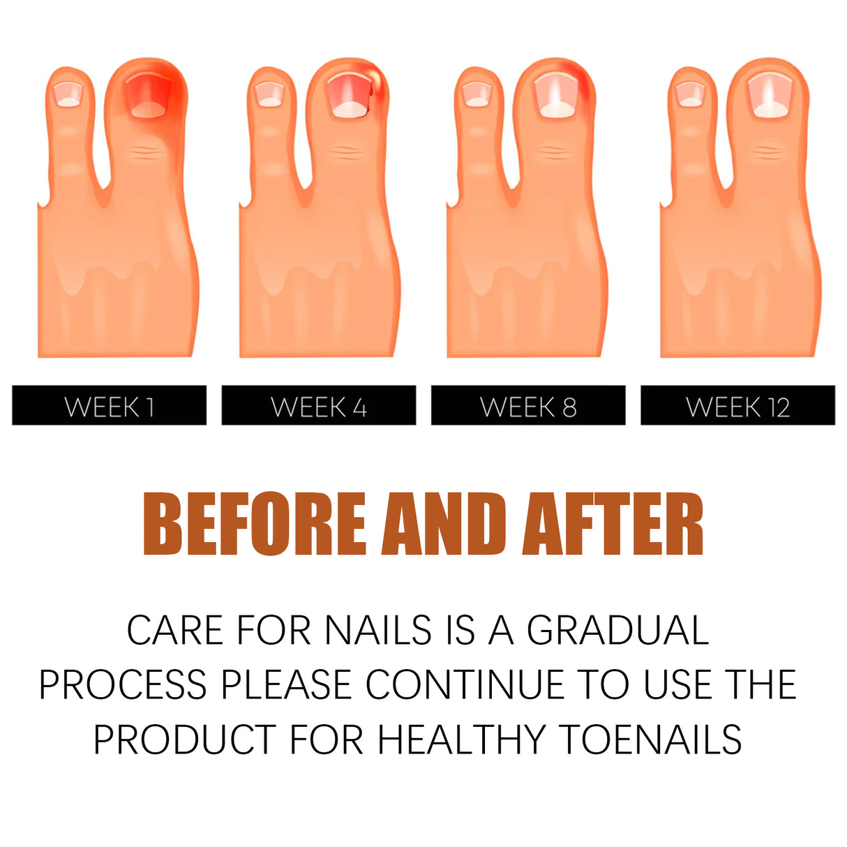 Anti-Nail Groove Relief Oil, Repair Inlaid Nails Gray Nails And Soft Thickening Nail Brightening Nails Care Oil - V.I.P Digital Presence