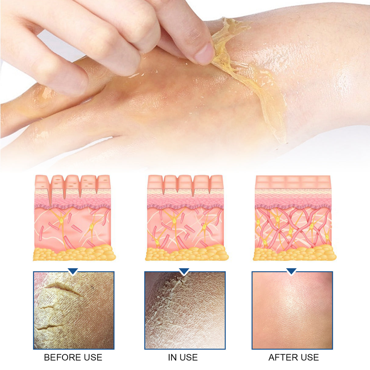 Exfoliating Hand Mask Moisturizes And Moisturizes Tender Skin, Alleviates Dry, Rough And Chapped Hands