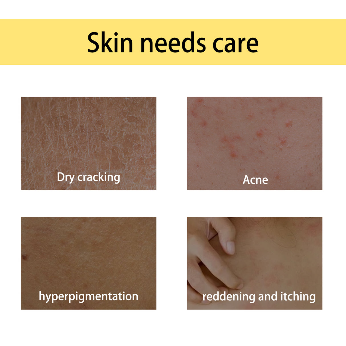 Handcrafted Body Oil, Moisturizing And Hydrating Massage Essential Oil For Soothing Tired Skin - V.I.P Digital Presence