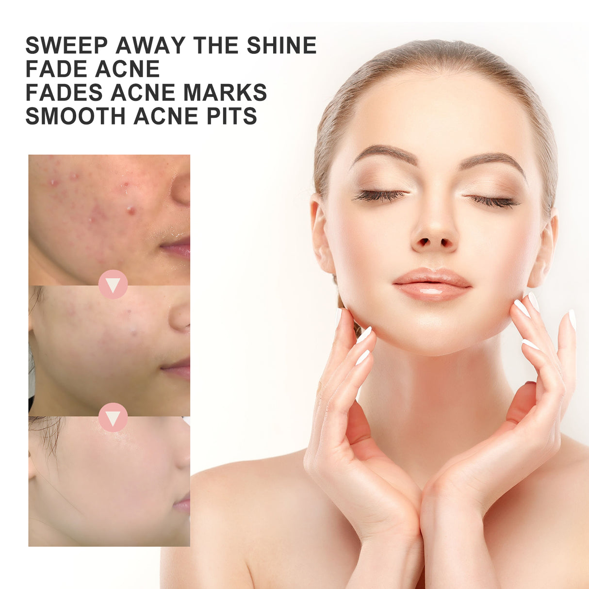 Acne Patch, Repair Acne Pimple Facial Redness Clean Pores Moisturize Skin Patch - V.I.P Digital Presence