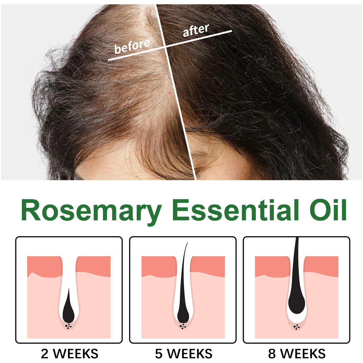Rosemary Hair Care Essential Oil Repair Split End Dry Hair, Nourish And Smooth Hair Care Oil - V.I.P Digital Presence