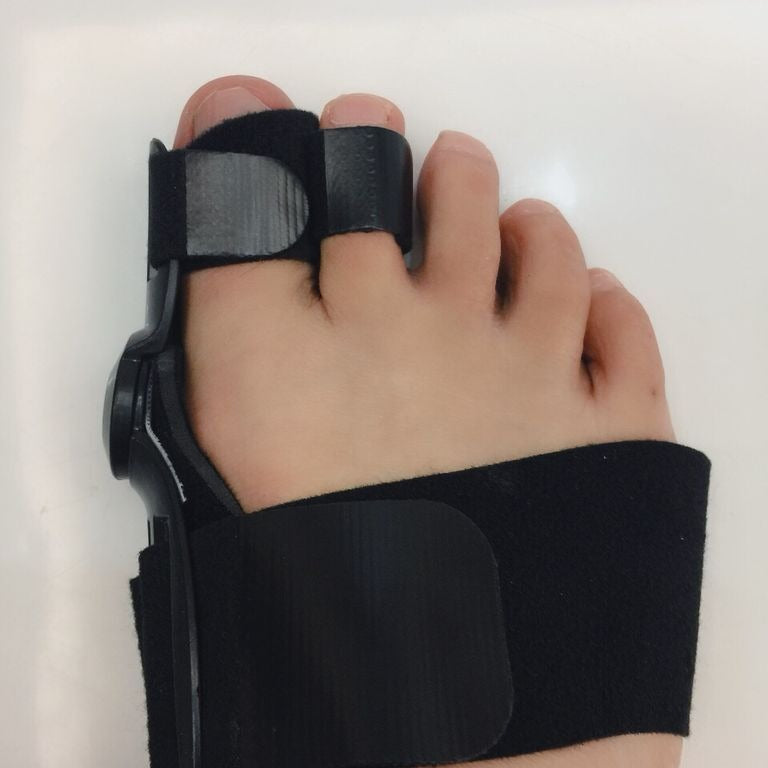 Day And Night Use Of Hallux Valgus Orthosis Thumb Valgus Orthosis Toe Orthosis - V.I.P Digital Presence