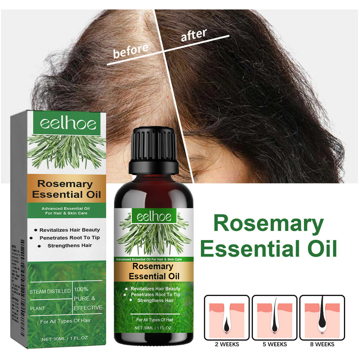 Rosemary Essential Oil, Anti-Hair Loss Refreshing, Nourishing, Smooth Hair Thick Hair And Scalp Care Essential Oil - V.I.P Digital Presence