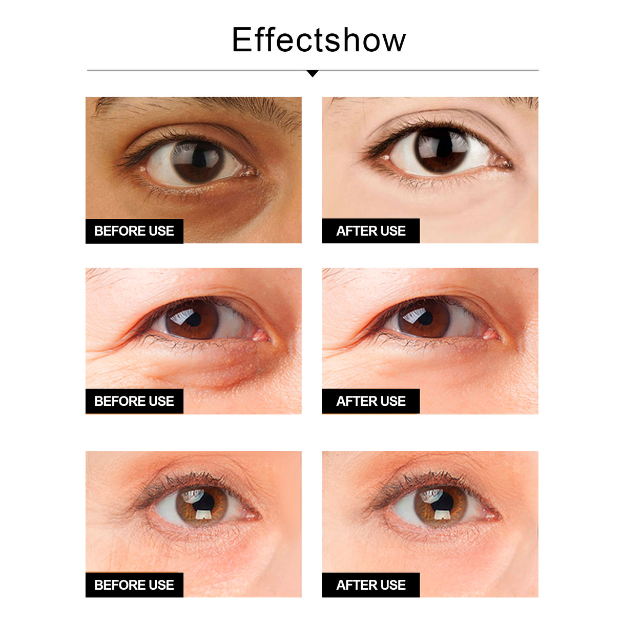 Snake Venom Eye Cream, Firming Eye Bags Hydrating And Reducing Fine Lines Eye Care Eye Cream - V.I.P Digital Presence