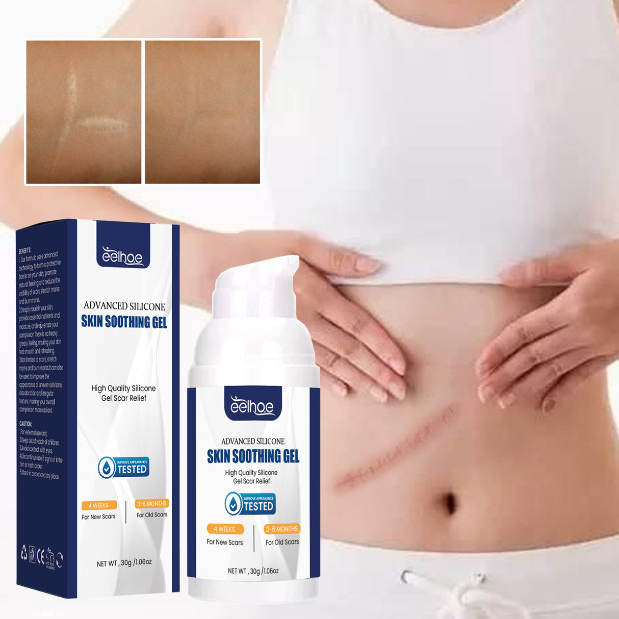 Scar Gel, Fade Skin Scar Pregnancy Surgery Scar Moisturizing Skin Care Gel - V.I.P Digital Presence