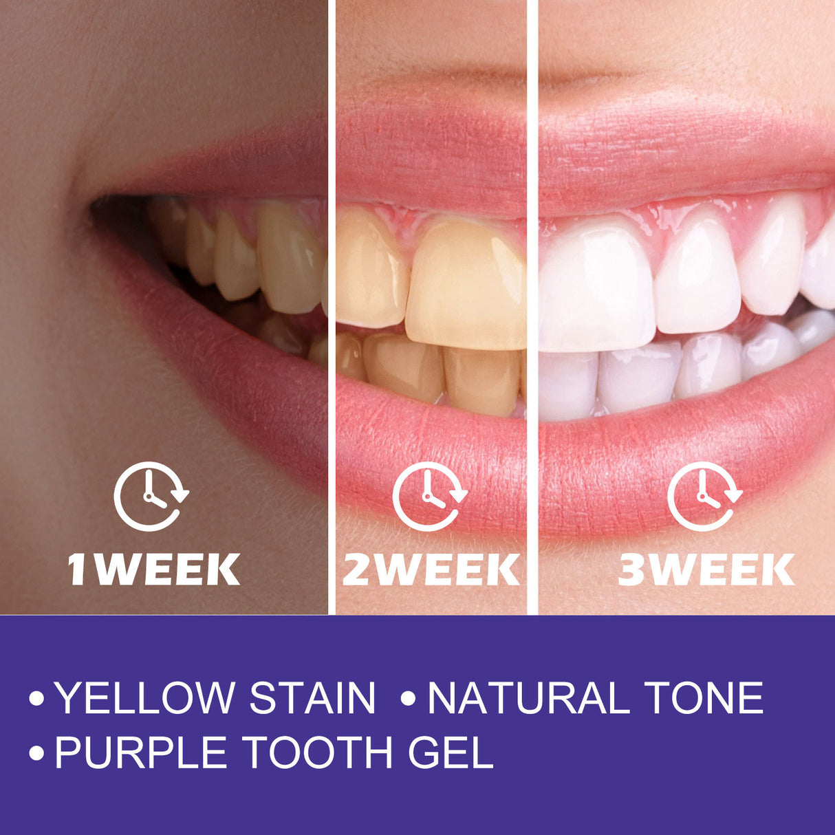 Cleaning Care Stains Yellow Teeth White To Remove Odor And Fresh Mouth - V.I.P Digital Presence