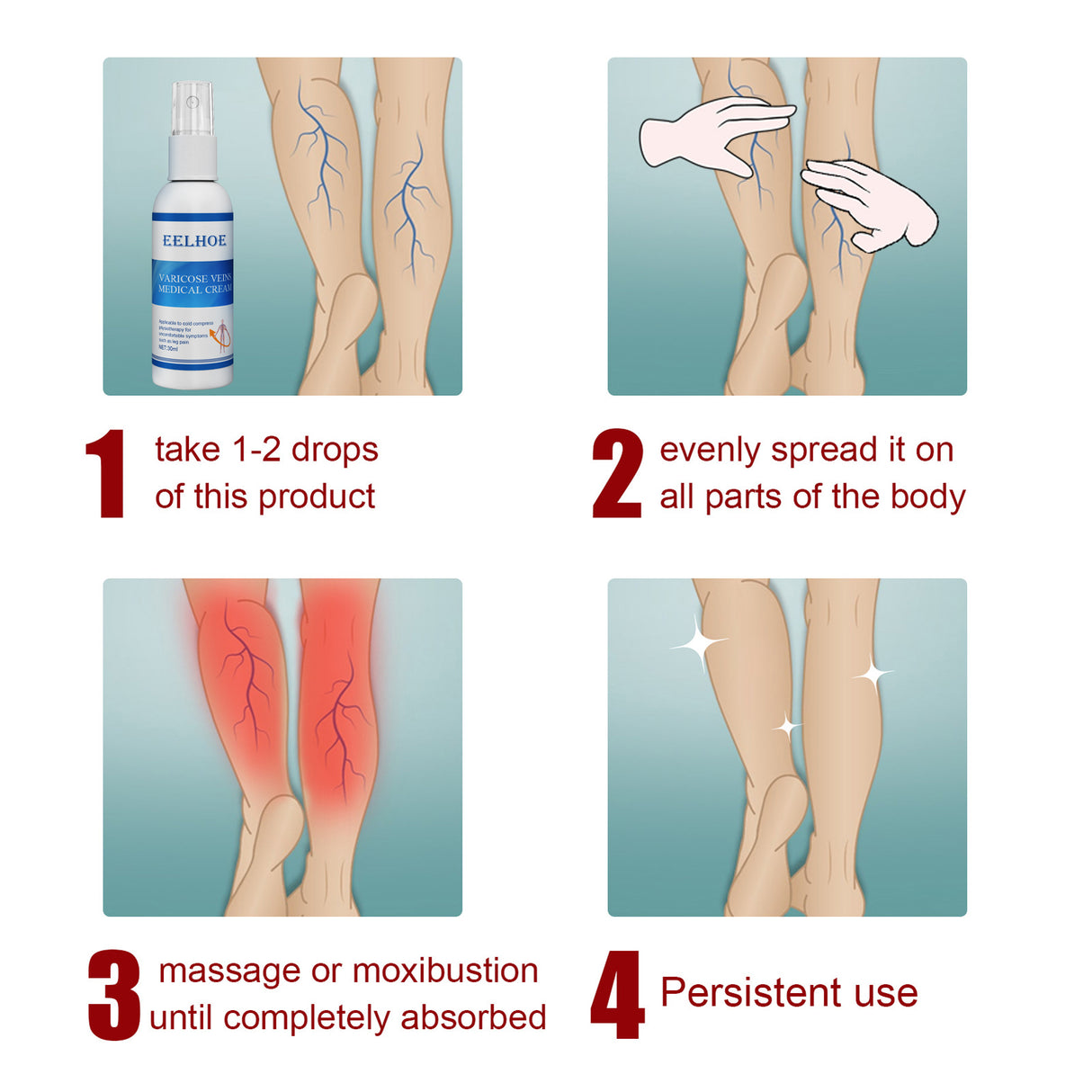 Intravenous Massage Spray For Varicose Veins Relief And Earthworm Leg Blood Vessel Bulge Pain Spray - V.I.P Digital Presence