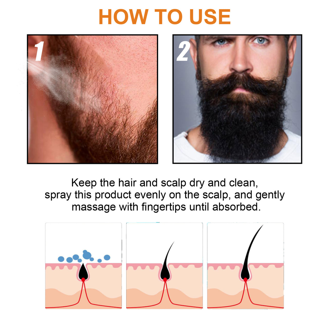 Hair Growth Spray, Men Hair And Beard Thickening Strengthening Anti-loss Care Solution - V.I.P Digital Presence