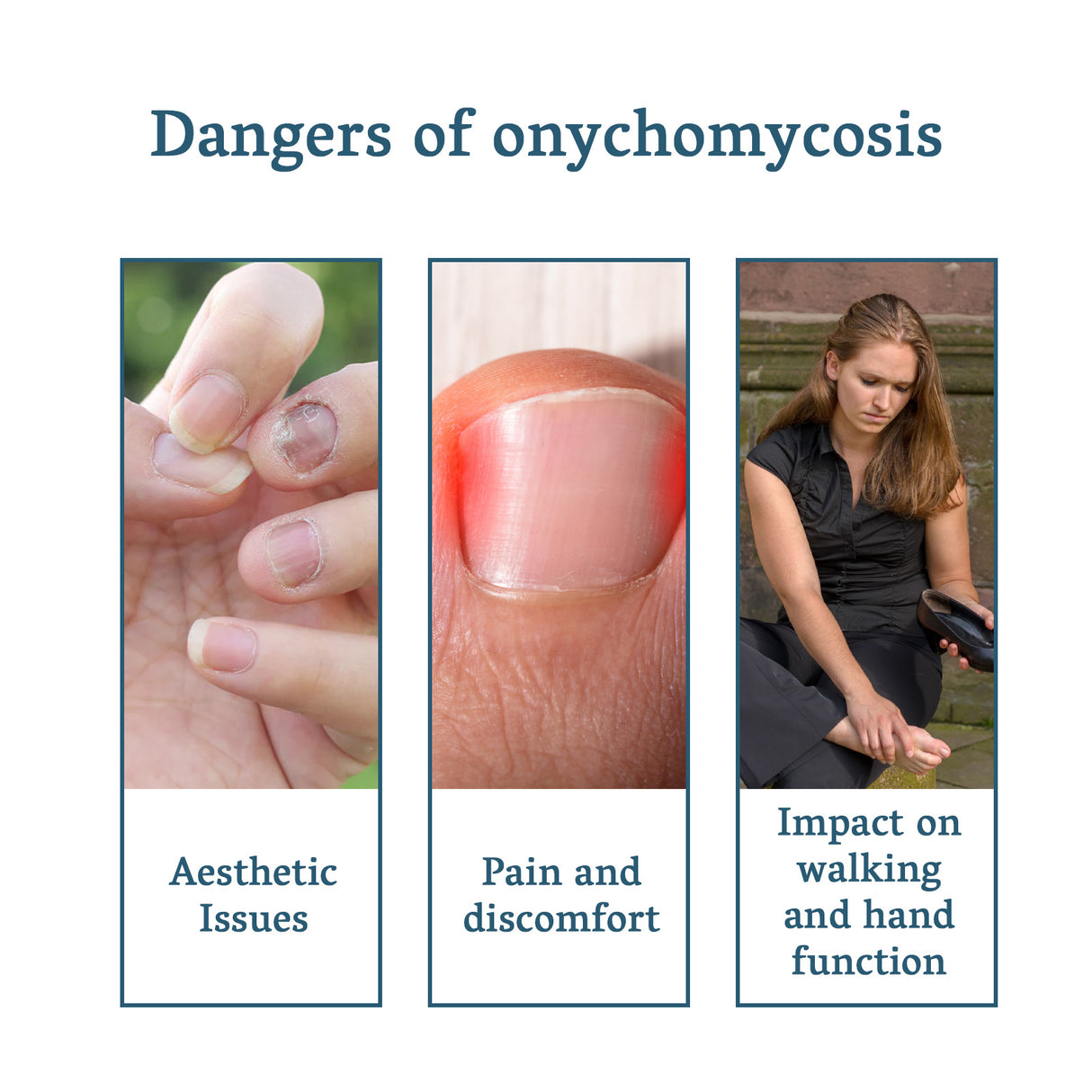 Nail Fungus Treatment, Nail Thickening Of Embedded Light Mail This Soft Armour Brothers Nails Detailer - V.I.P Digital Presence