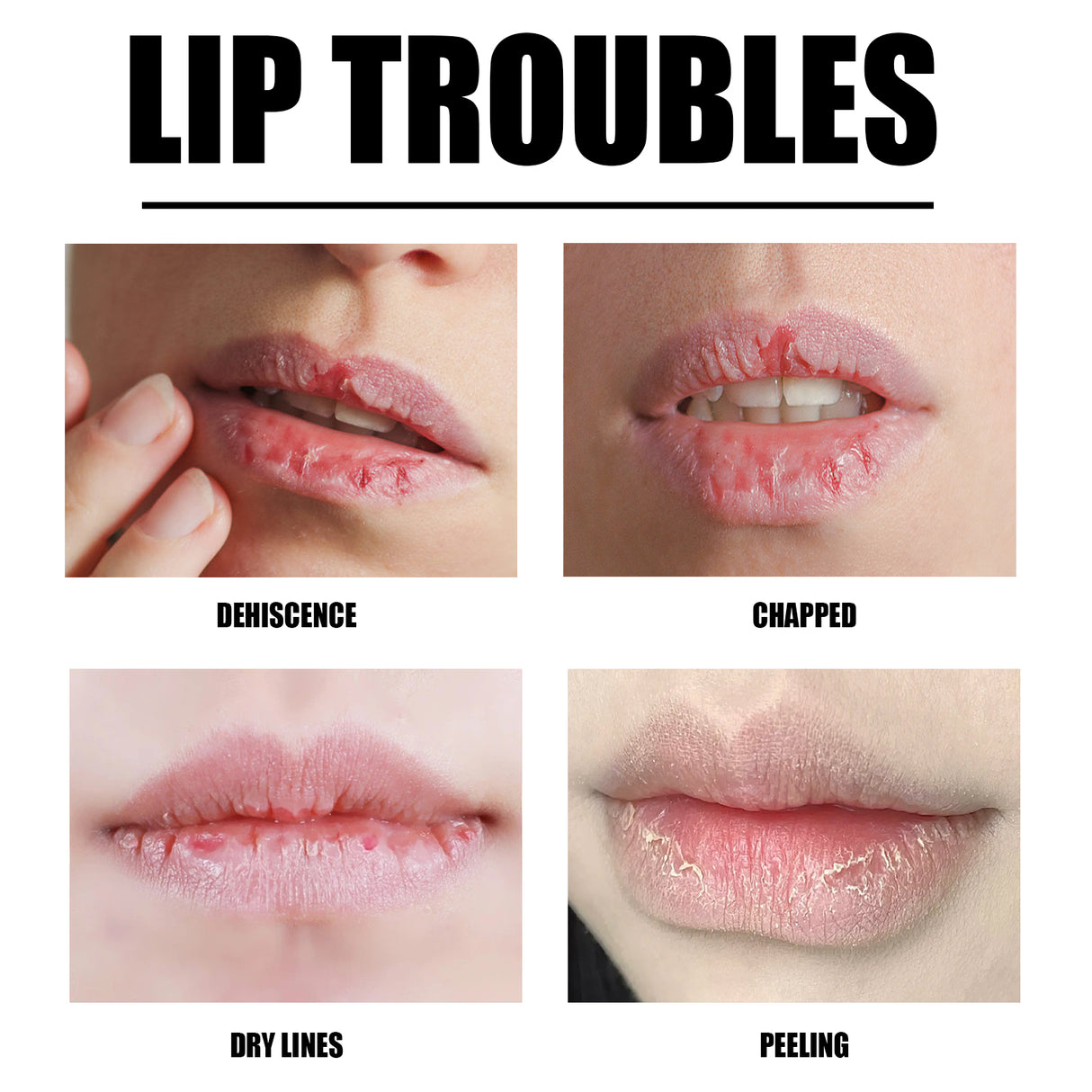 Lip Scrub, Lip Wrinkles Dry Dead Skin Moisturizing Toot Lips Moist Lips Lip Care - V.I.P Digital Presence