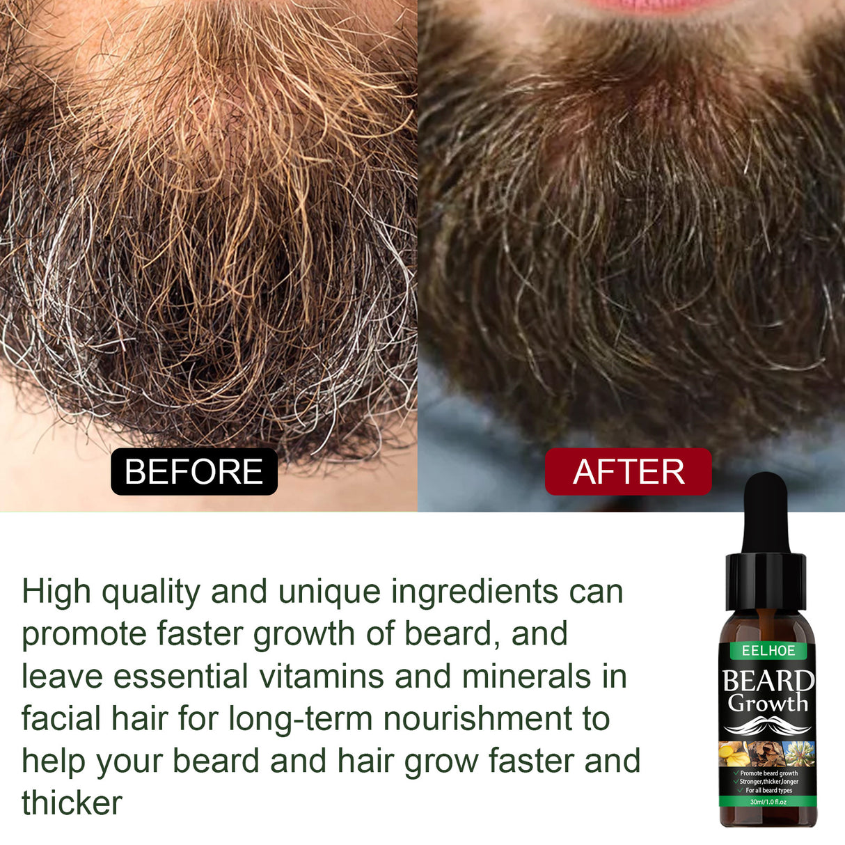 Beard Oil, Nourishing Moisturizing Spray Facial Hair Treatment Promotes Facial Growth And Thickening Liquid - V.I.P Digital Presence