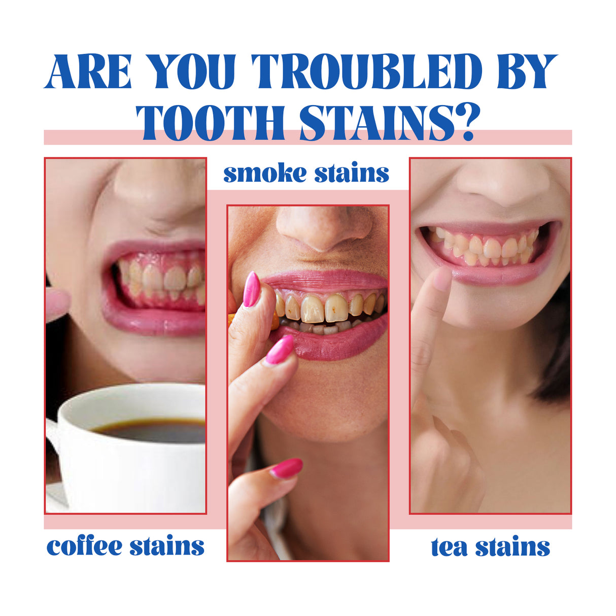 Probiotic Brightening Toothpaste, Oral Cleaning Remove Odor Stains White Teeth Gum Care Toothpaste - V.I.P Digital Presence