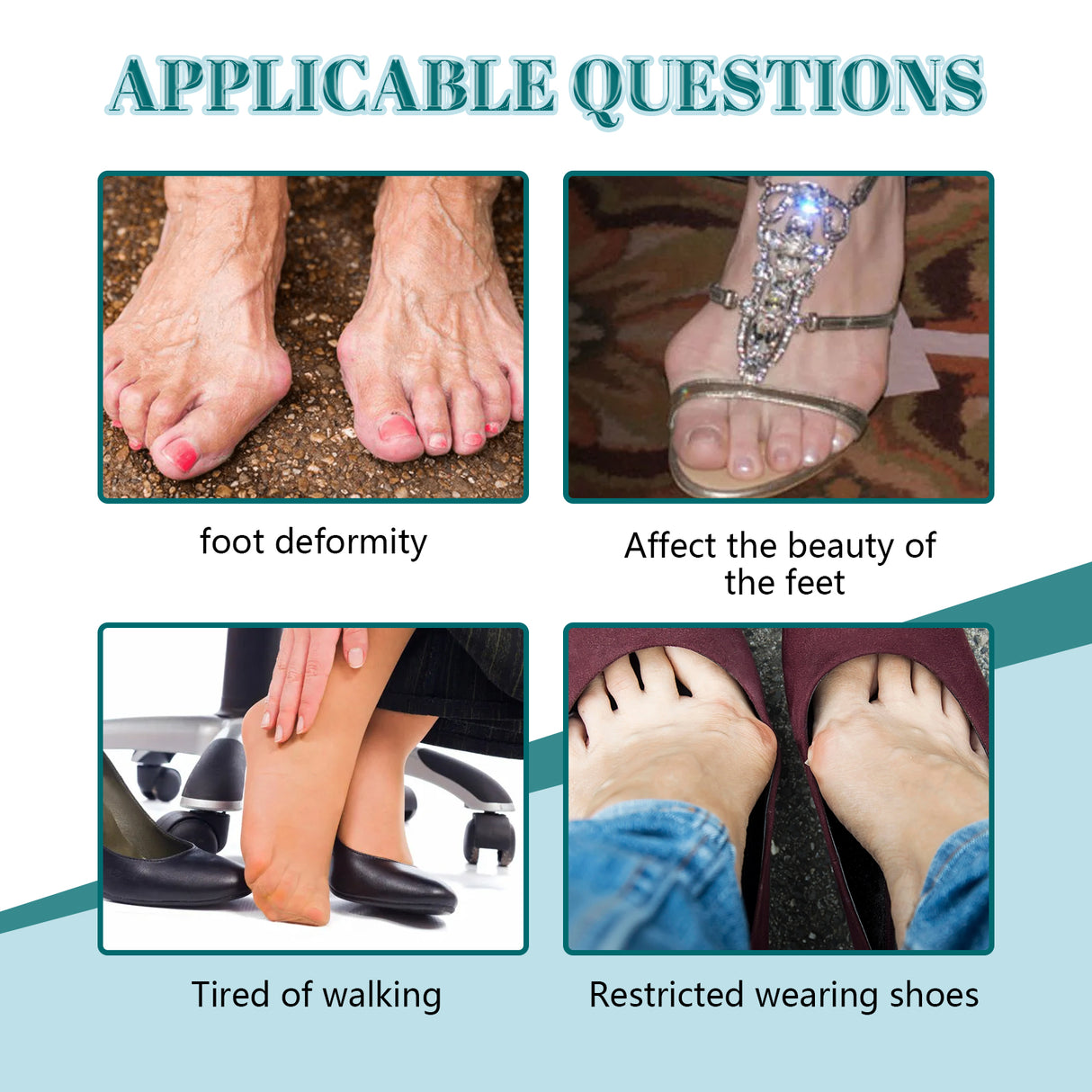 Bunion Patch, Relieves Toes Swelling And Pain Corrects Thumb Valgus Herbal Care Patch - V.I.P Digital Presence