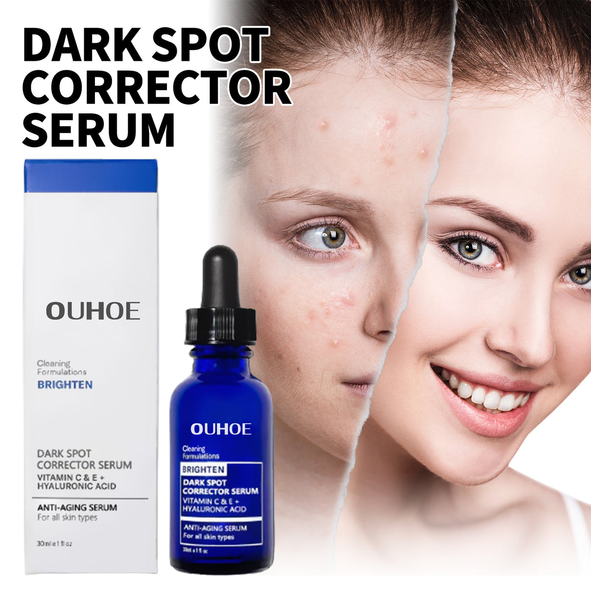 Dark Spot Repair Essence, Repair Acne Pimple Lightening Spot Fine Lines Moisturizing Firming Whitening Essence - V.I.P Digital Presence