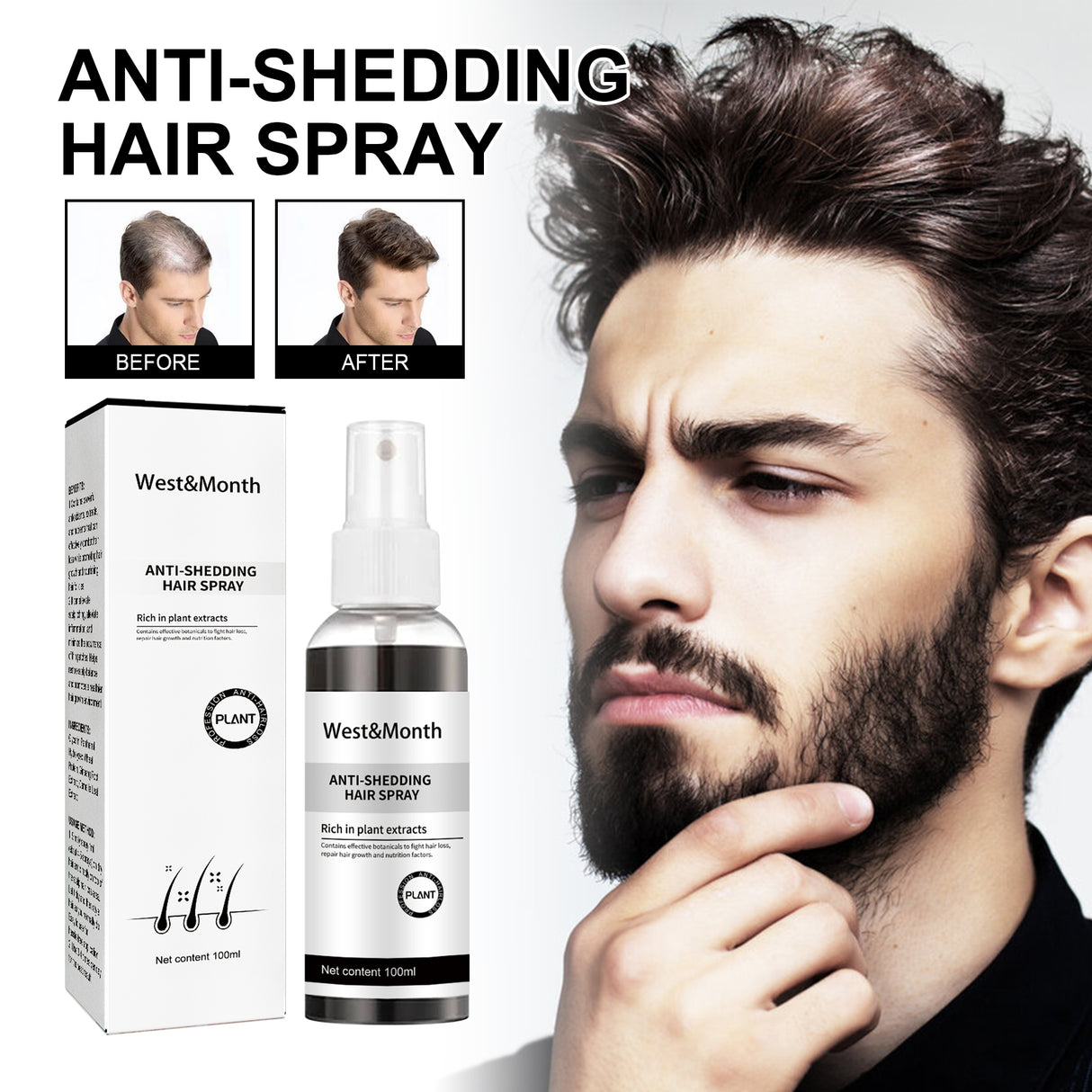 West & Month Anti-Shedding Hair Spray, Improve The Hairline Hair Hair Nutrition Moisture Hair Roots - V.I.P Digital Presence