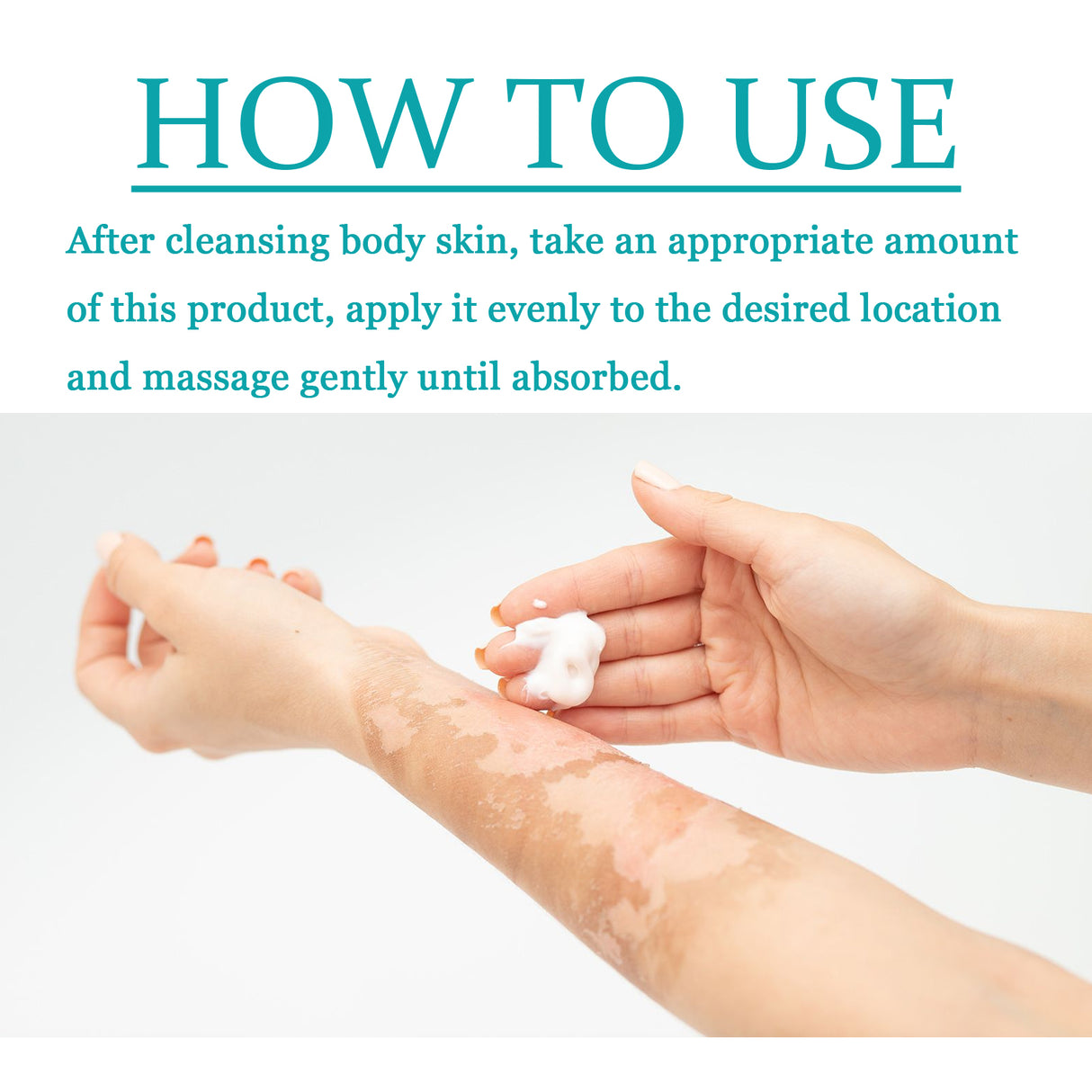 Vitiligo Fix Revitalizing Elixir, Lighten Skin Spots Even Skin Tone Moisturizing Body Care Repair Cream - V.I.P Digital Presence