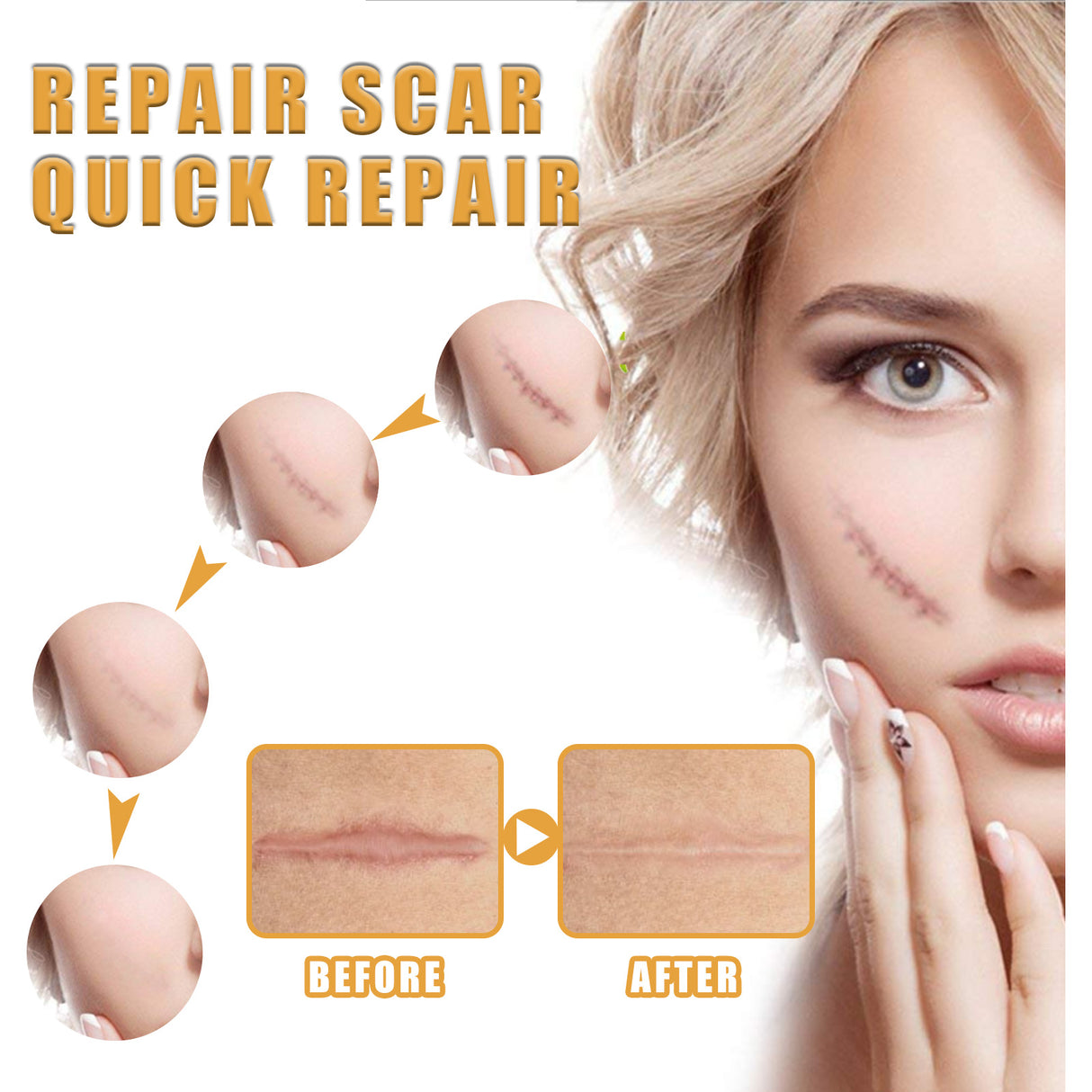 Desalting Skin Scar Cream, Skin Burn Scalding Surgical Scar Wound Repair Cream - V.I.P Digital Presence