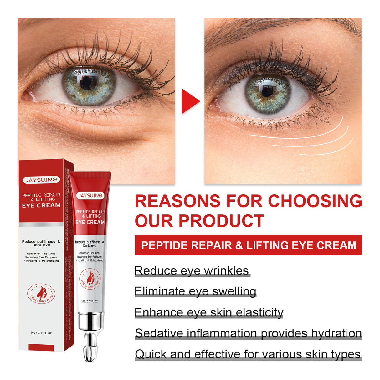 Nourishing And Moisturizing Eye Cream Keeps The Skin Around The Eyes Soft And Moisturized With A Gentle Daily Eye Cream - V.I.P Digital Presence