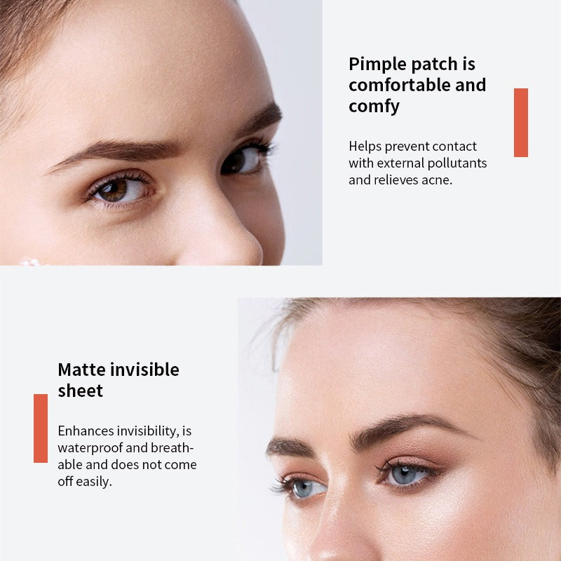 Youbuy invisible acne patch concealer acne patch acne remover without powder stuck acne patch 72 PATCHES - V.I.P Digital Presence