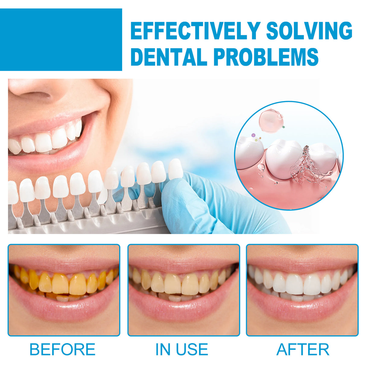 Mouth Mousse Toothpaste Teeth Clean Teeth Remove Tartar Stains Yellow Teeth Whitening Teeth Fresh Breath - V.I.P Digital Presence