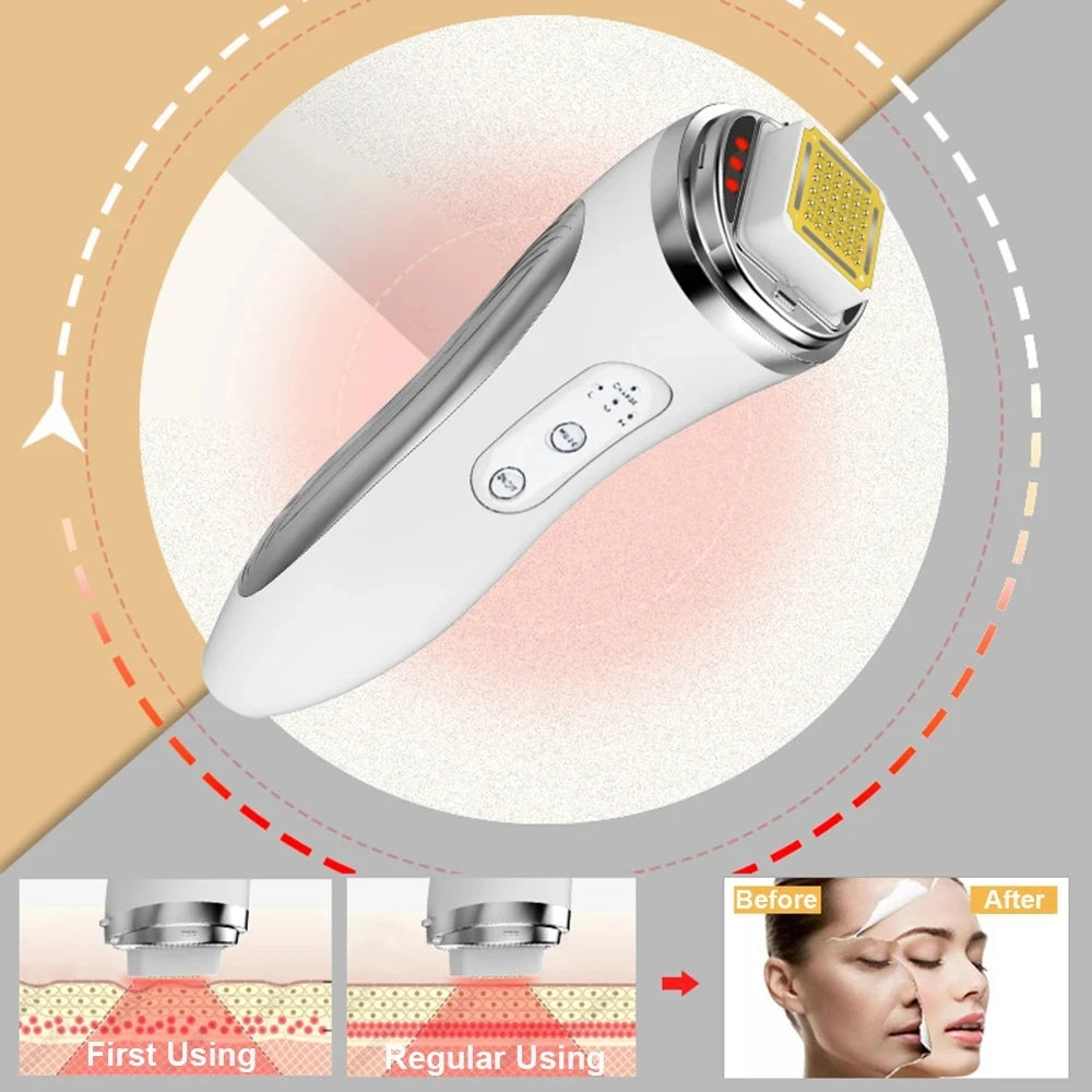 Electric Facial Lifting Machine Dot Matrix Skin Tightening Rejuvenation Wrinkle Removal Face Massager Home Use Beauty Devices - V.I.P Digital Presence