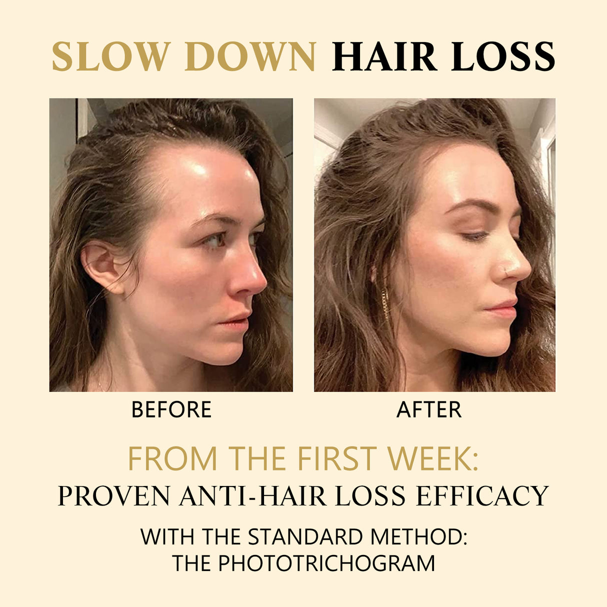 Hair Boost Darken Strengthen Essence, Scalp Massage Moisturizing Hair Roots Thick Smooth Hair Care Ball - V.I.P Digital Presence