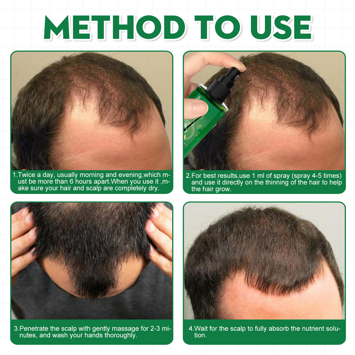 Men's Hair Serum For Hair Stabilization Nourishes And Nourishes Your Hairline - V.I.P Digital Presence