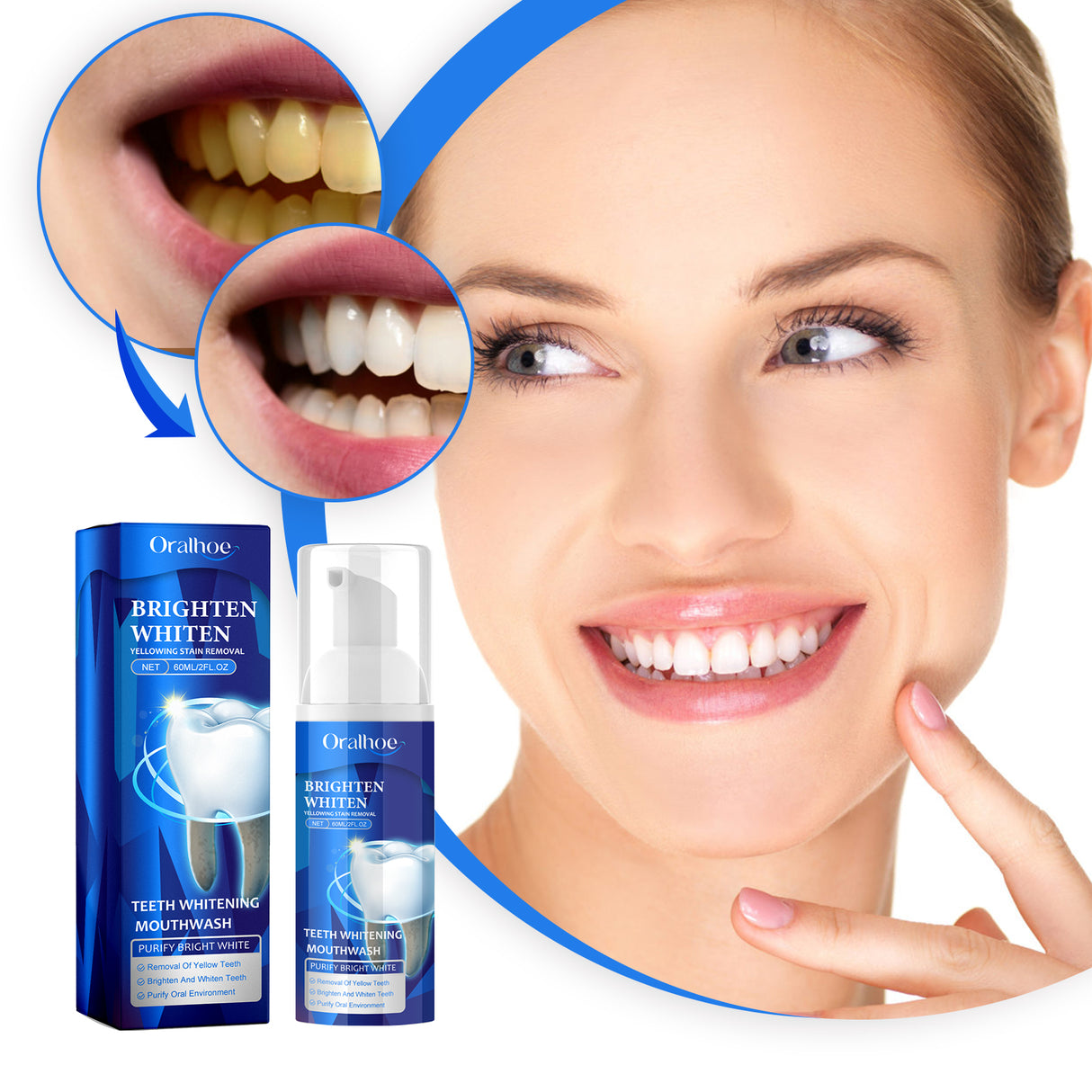 Teeth Whitening Mouthwash, Teeth Cleaning Teeth Yellow Stains Tartar Beauty Teeth Fresh Breath Oral Care - V.I.P Digital Presence