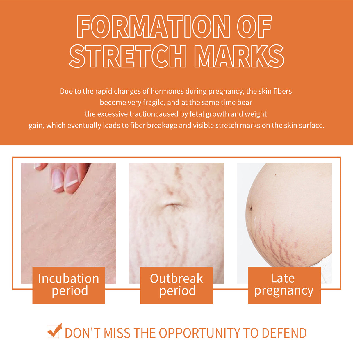 Pregnancy Massage Oil, Repair Pregnant Women Prenatal And Postpartum Stretch Mark Skin Care Massage Oil - V.I.P Digital Presence