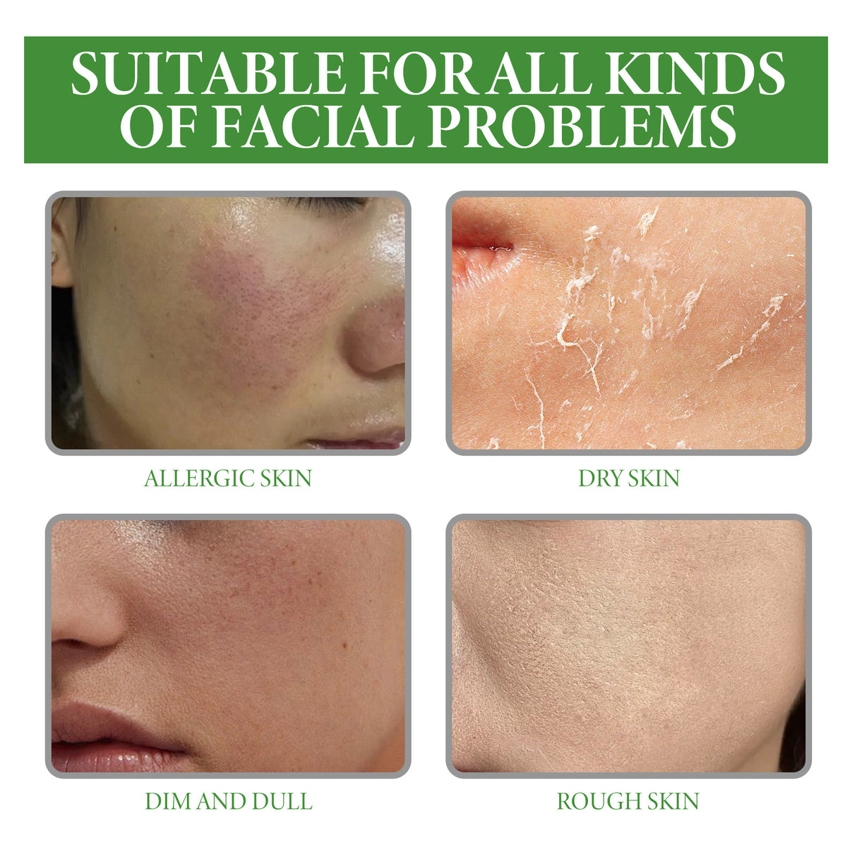 Aloe Vera Serum, Repair Dry Skin Moisturizes And Hydrates To Lighten Pimples And Seal Delicate Pores - V.I.P Digital Presence