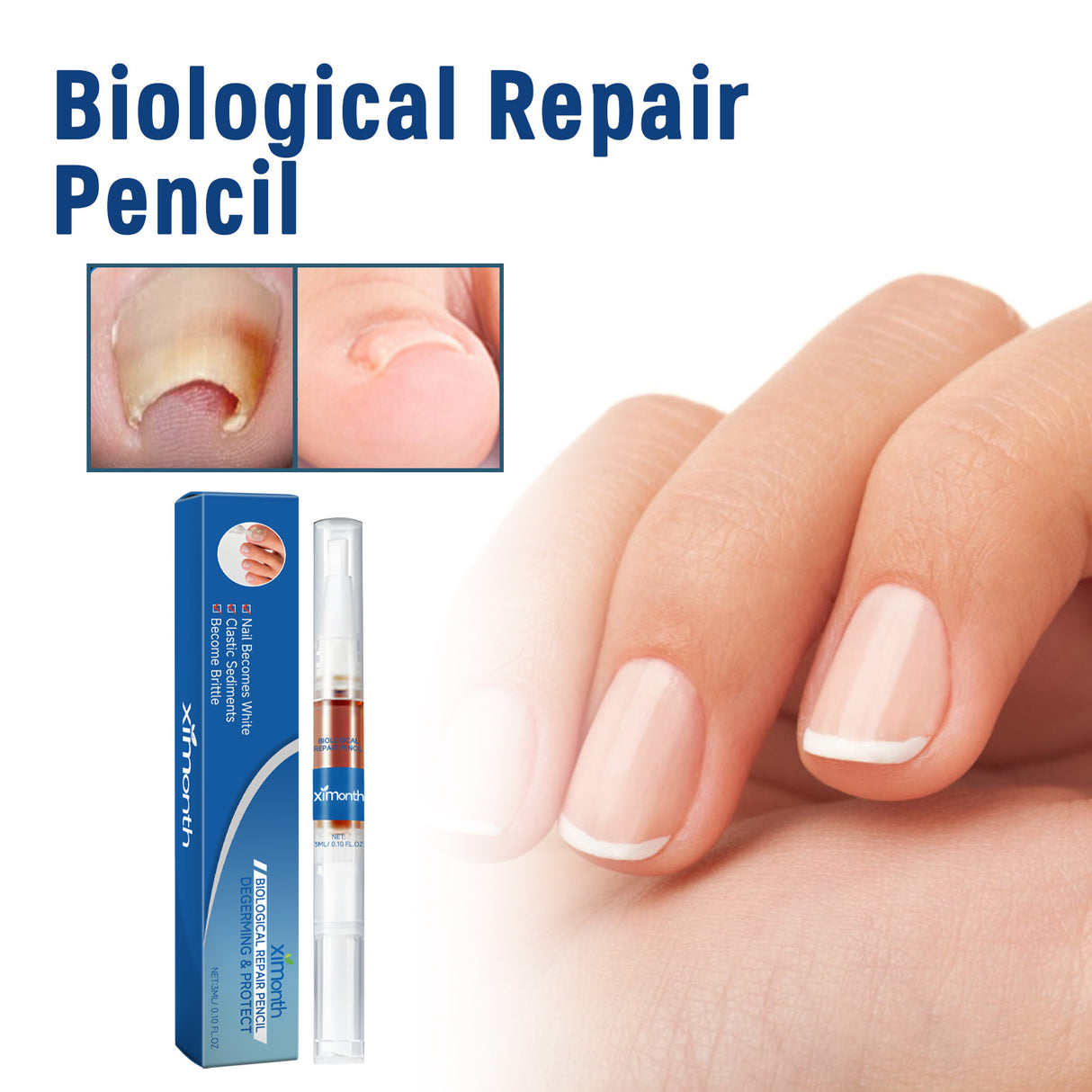 Biological Repair Pencil, Hand, Foot And Nail Care Thickening Repair Soft Nail Insert Nail Bright Nail Nail Pen - V.I.P Digital Presence
