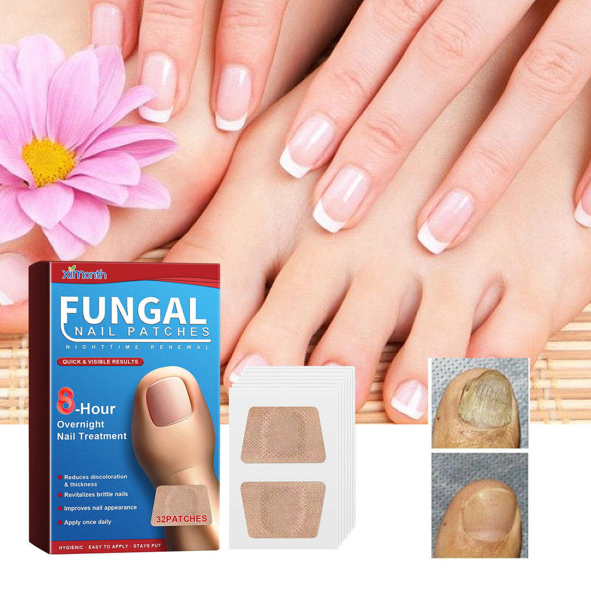Nighttime Renewal Fungal Nail Patches, Repair And Thickening Gray Nail Insert Soft Nail Care Patch - V.I.P Digital Presence