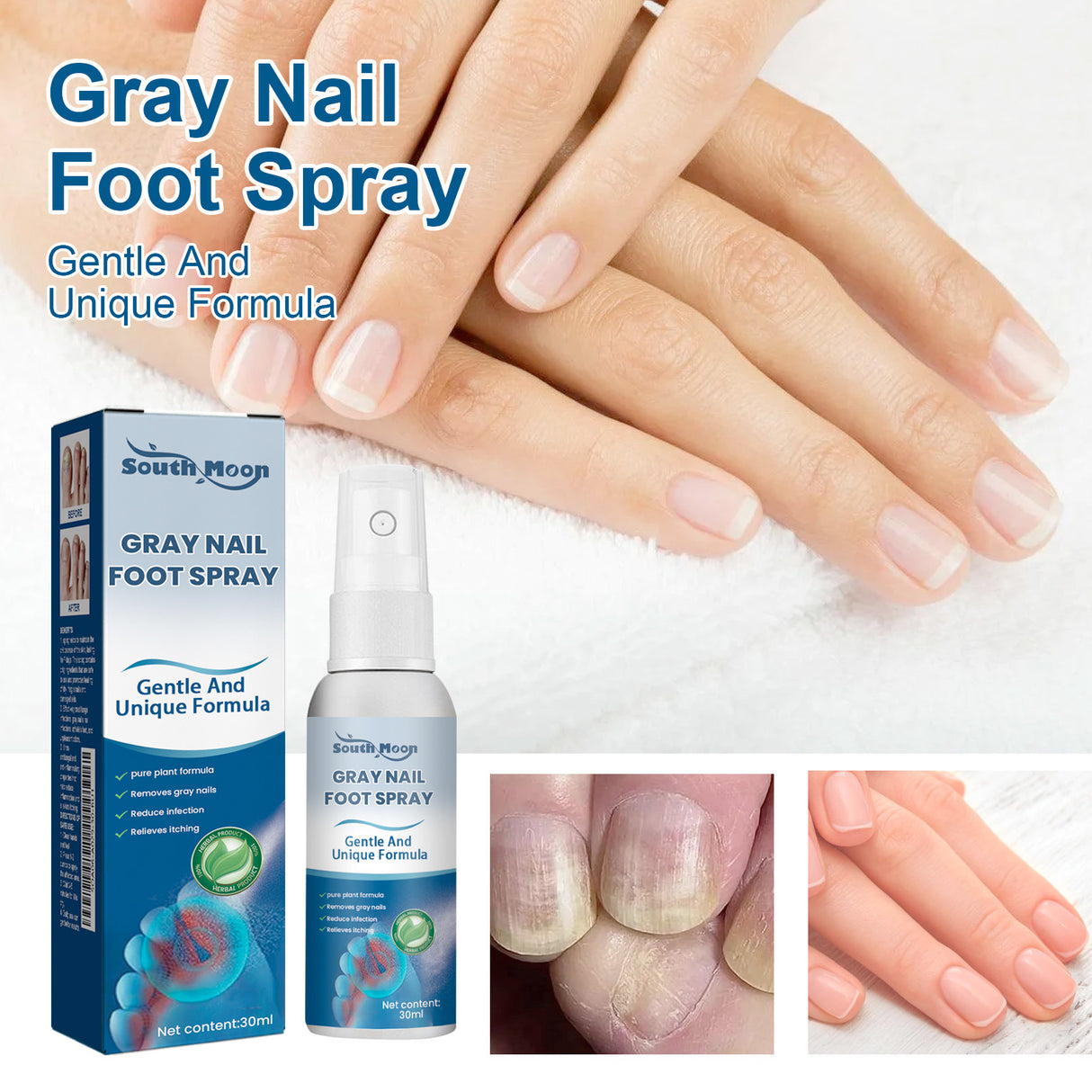 Nail Care Spray Gently Cleans Foot Nails Moisturizing And Brightening Nail Care Spray - V.I.P Digital Presence