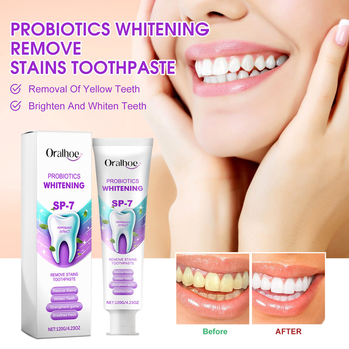 Probiotics Whitening Remove Stains Toothpaste, Dental Care Cleaning Oral Odor Toothstains Tartar Beautifying Teeth Whitening - V.I.P Digital Presence