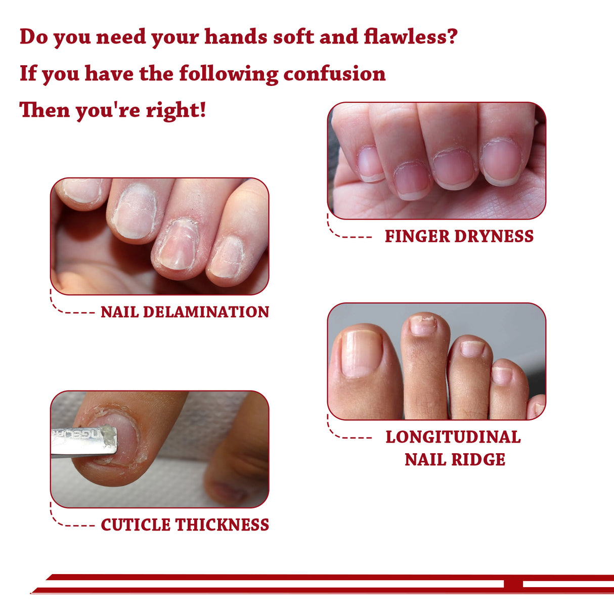 Cuticle Oil, Strengthen Nail Cuticle Moisturize Nourishing Nail Edge Nail Care Oil - V.I.P Digital Presence