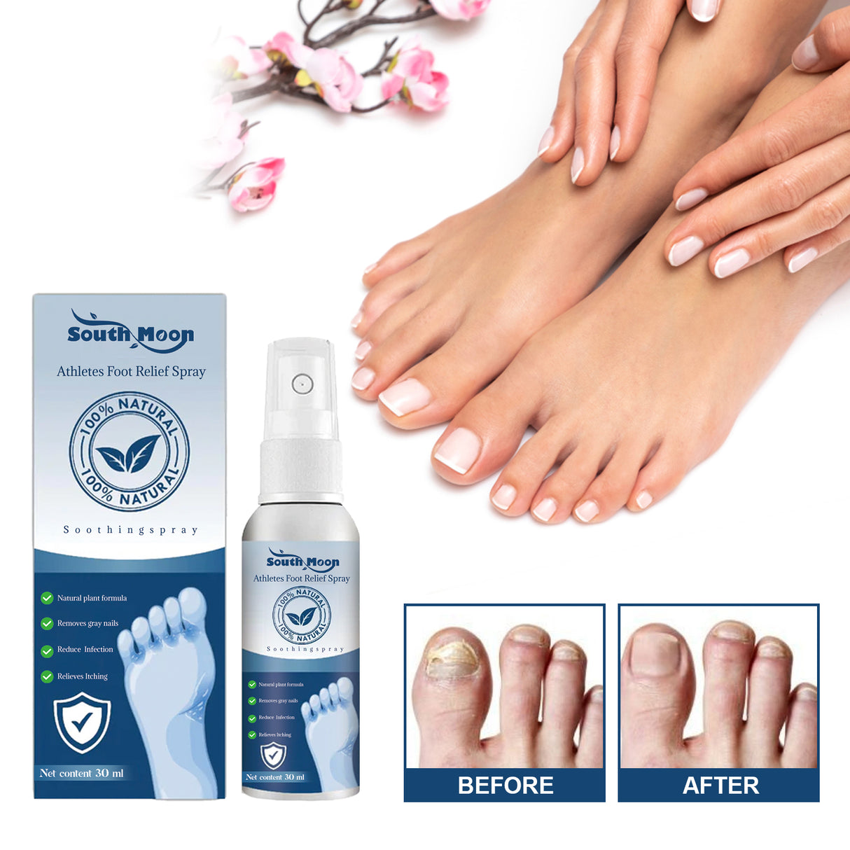 Athletes Foot Relief Spray, Relieve Foot Sweat Foot Itching Peeling Gray Nails Foot Odor Moisturizing Care Spray - V.I.P Digital Presence