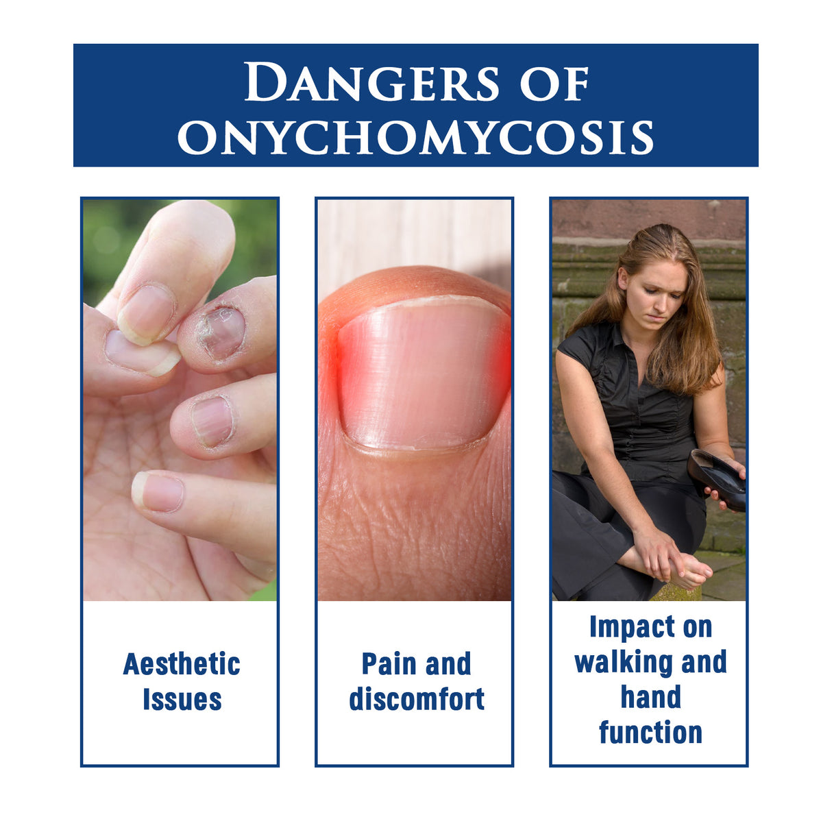 Biological Repair Pencil, Hand, Foot And Nail Care Thickening Repair Soft Nail Insert Nail Bright Nail Nail Pen - V.I.P Digital Presence