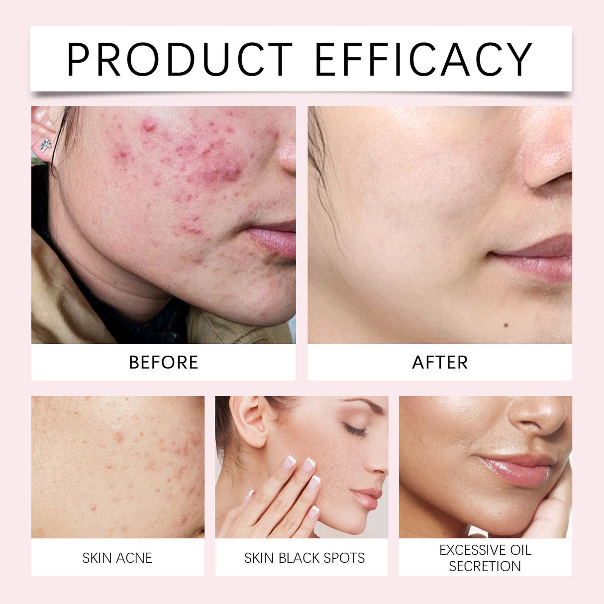 EELHOE Turmeric Kojic Acid Cleansing Pads Exfoliating Pads Facial Sponges For Cleansing Exfoliating Daily Cleansing Skin Care (40 PCS) - V.I.P Digital Presence