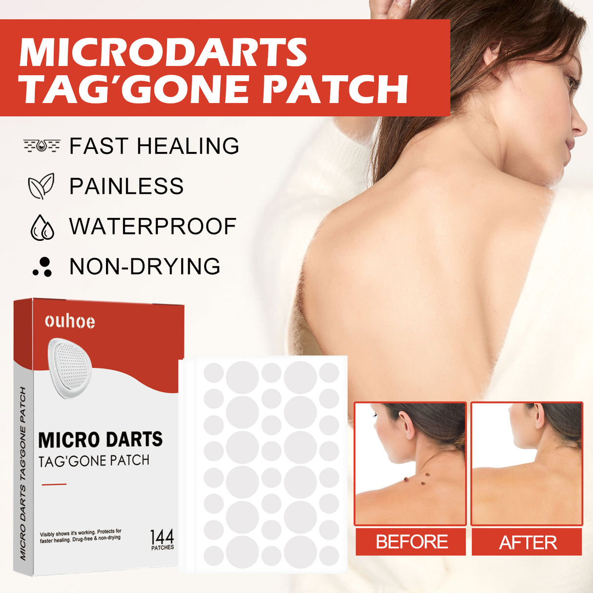 Acne Patch, Skin Clean Acne Pimple Moles Gram Wart Corns Spot Patch - V.I.P Digital Presence