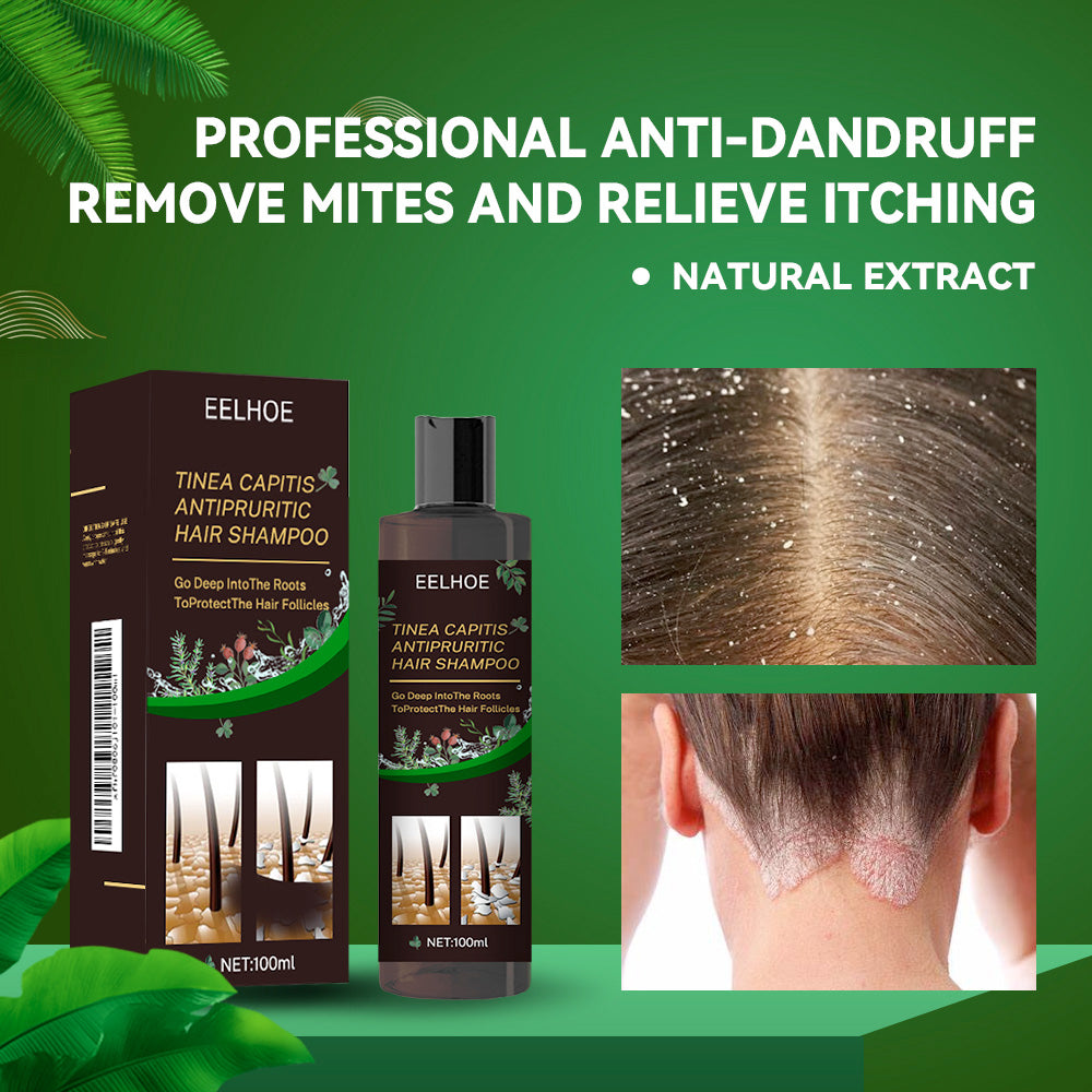 Tinea Capitis Anti-Itch Shampoo Anti-Drop Refreshing Oil Control Hair Care Anti-Dandruff Anti-Itch Shampoo - V.I.P Digital Presence